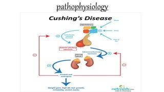 pathophysiology
 