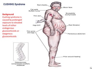 Background
Cushing syndrome is
caused by prolonged
exposure to elevated
levels of either
endogenous
glucocorticoids or
exogenous
glucocorticoids
 