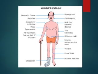 cushing syndrome AND DEATILES EXPLANAtion | PPTX