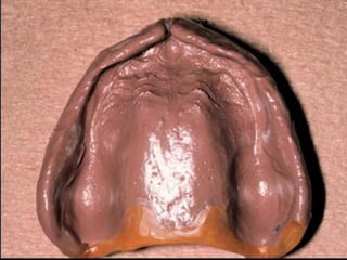 Custom impression cd