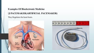 Customized Drug Delivery System Bioelectronic device, 3D printing and ...