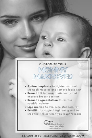 Customize Your Mommy Makeover