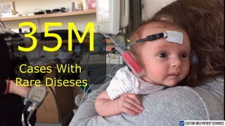 4
35M
Cases With
Rare Diseses
 