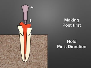 Custom post & core ( lab procedure) | PDF