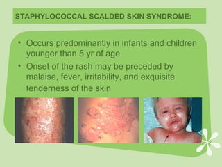 Cutaneous Bacterial Infections | PPT