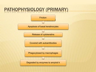PATHOPHYSIOLOGY (PRIMARY)
Friction
Friction
Apoptosis of basal keratinocytes
Release of cytokeratins
Covered with autoantibodies
Phagocytosed by macrophages
Degraded by enzymes to amyloid k
 