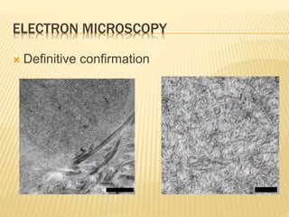 ELECTRON MICROSCOPY
 Definitive confirmation
 