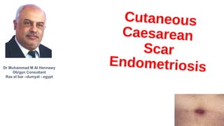 Cutaneous
Caesarean
Scar
EndometriosisDr Muhammad M Al Hennawy
Ob/gyn Consultant
Ras el bar –dumyat - egypt
 