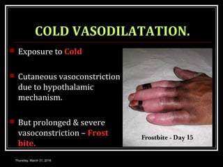COLD VASODILATATION.
 Exposure to Cold
 Cutaneous vasoconstriction
due to hypothalamic
mechanism.
 But prolonged & severe
vasoconstriction – Frost
bite.
Thursday, March 31, 2016
 