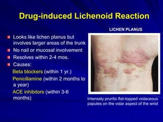 Cutaneous Drug Reactions [Autosaved].ppt 2.pdf