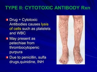 Cutaneous Drug Reactions [Autosaved].ppt 2.pdf