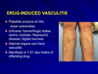 Cutaneous Drug Reactions [Autosaved].ppt 2.pdf
