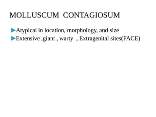 ▶Atypical in location, morphology, and size
▶Extensive ,giant , warty , Extragenital sites(FACE)
MOLLUSCUM CONTAGIOSUM
 