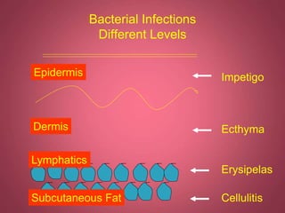 Cutaneous Infections of skin disease management | PPT