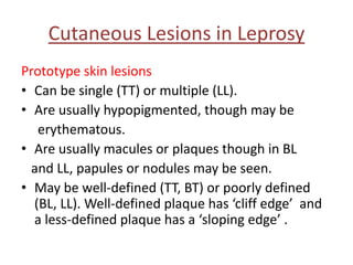 Cutaneous Lesions in Leprosy
Prototype skin lesions
• Can be single (TT) or multiple (LL).
• Are usually hypopigmented, though may be
erythematous.
• Are usually macules or plaques though in BL
and LL, papules or nodules may be seen.
• May be well-defined (TT, BT) or poorly defined
(BL, LL). Well-defined plaque has ‘cliff edge’ and
a less-defined plaque has a ‘sloping edge’ .
 