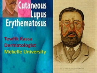 Tewfik Kassa
Dermatologist
Mekelle University
 