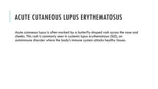 Cutaneous Lupus Erythematosus overview.pptx