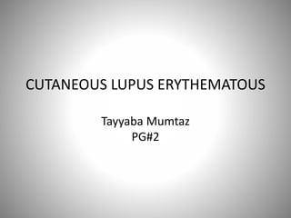 CUTANEOUS LUPUS ERYTHEMATOUS
Tayyaba Mumtaz
PG#2
 