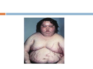 Endocrine Rashes Cutaneous manifestations of endocrine disease | PPTX
