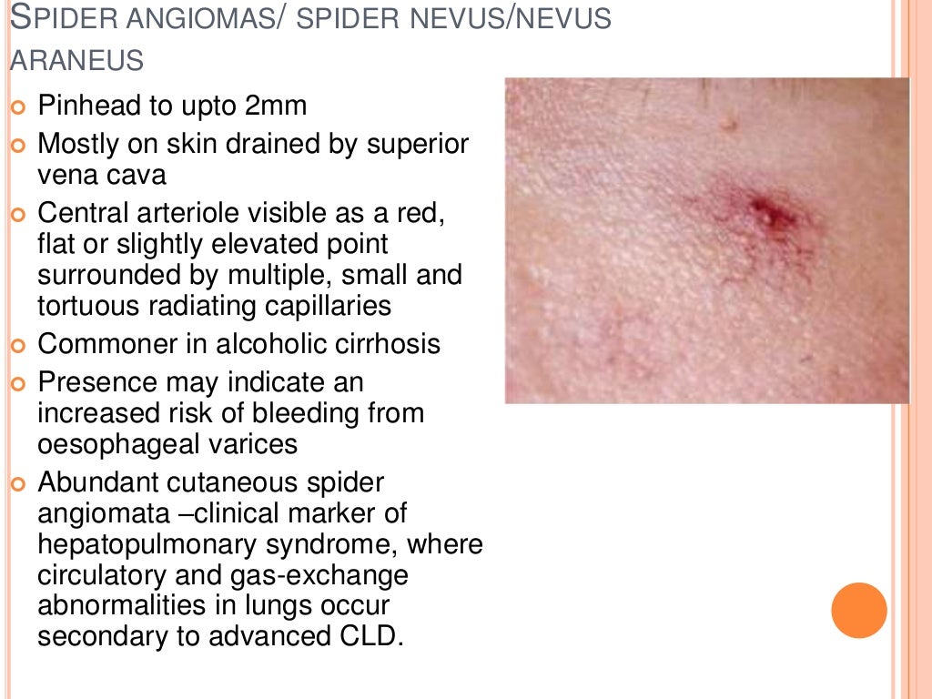 Cutaneous manifestations of internal diseases