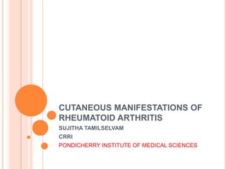 CUTANEOUS MANIFESTATIONS OF
RHEUMATOID ARTHRITIS
SUJITHA TAMILSELVAM
CRRI
PONDICHERRY INSTITUTE OF MEDICAL SCIENCES
 