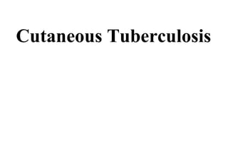 Cutaneous Tuberculosis
 