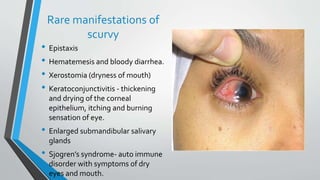 vitamin c deficiency symptoms lips Can Dry Lips Be a Sign of Vitamin Deficiency? – fatty15