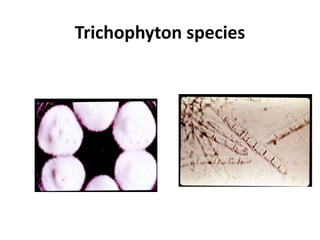 Trichophyton species
 