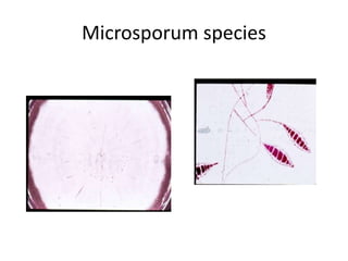 Microsporum species
Thick wall, spindle shape,
multicellular
 