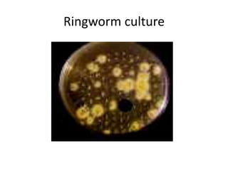 Ringworm culture
 