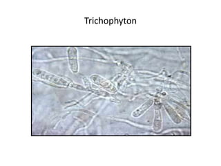 Trichophyton
 