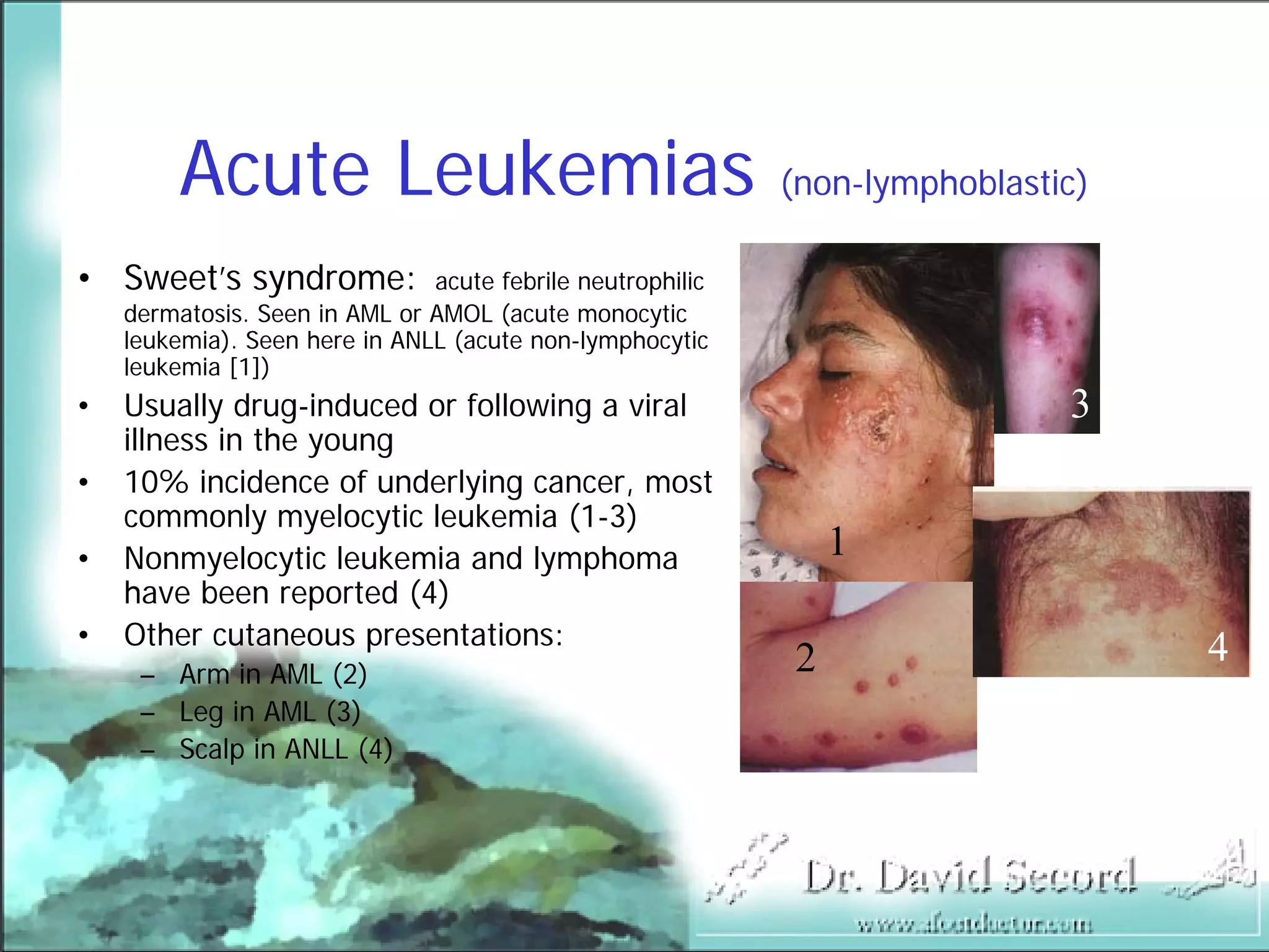 Cutaneous Presentations Of Systemic Diseases | PDF