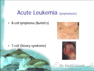 Cutaneous Presentations Of Systemic Diseases