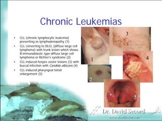 Cutaneous Presentations Of Systemic Diseases