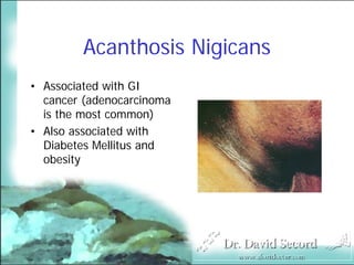 Cutaneous Presentations Of Systemic Diseases