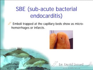 Cutaneous Presentations Of Systemic Diseases