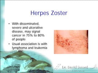 Cutaneous Presentations Of Systemic Diseases