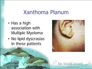 Cutaneous Presentations Of Systemic Diseases
