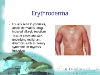 Cutaneous Presentations Of Systemic Diseases