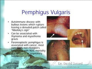 Cutaneous Presentations Of Systemic Diseases