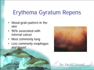 Cutaneous Presentations Of Systemic Diseases