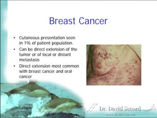 Cutaneous Presentations Of Systemic Diseases