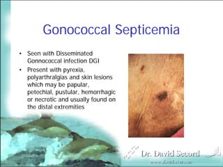 Cutaneous Presentations Of Systemic Diseases