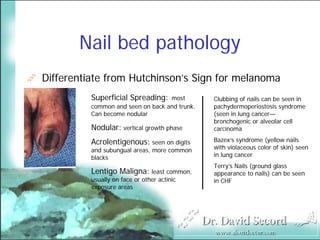 Cutaneous Presentations Of Systemic Diseases