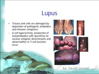 Cutaneous Presentations Of Systemic Diseases