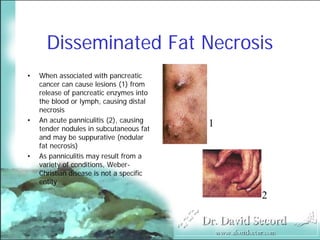 Cutaneous Presentations Of Systemic Diseases