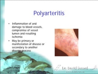 Cutaneous Presentations Of Systemic Diseases