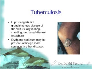 Cutaneous Presentations Of Systemic Diseases
