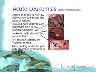 Cutaneous Presentations Of Systemic Diseases
