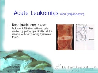 Cutaneous Presentations Of Systemic Diseases